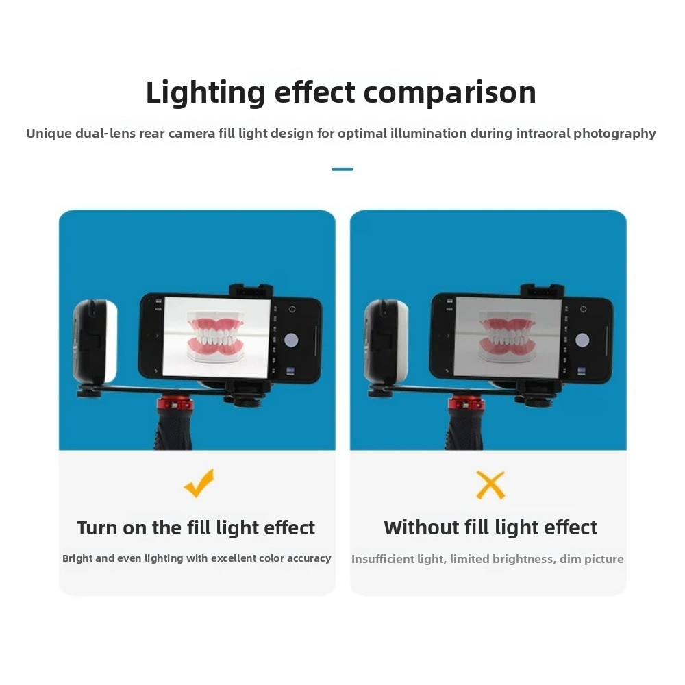 Dental Photography Light, Blue - Photography Lighting Products ulasan dan harga
